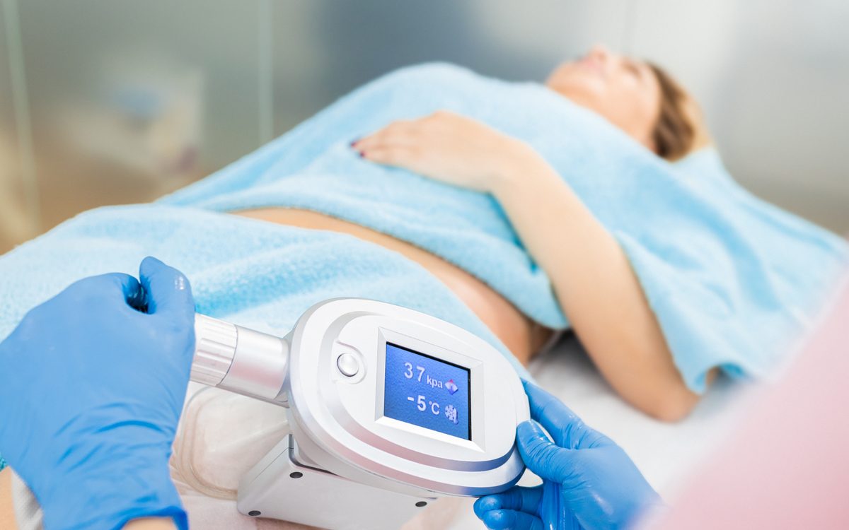 Cryolipolyse sur la face interne des cuisses.